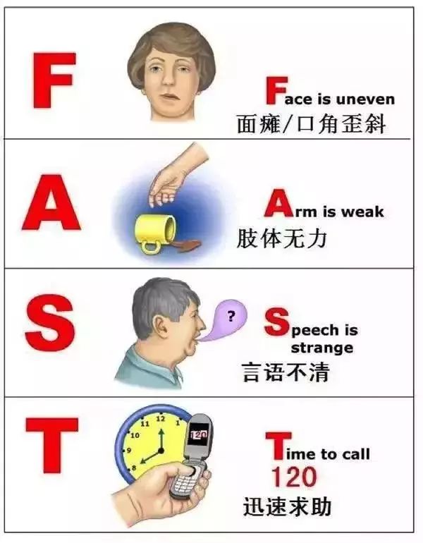 (识别脑卒中的"fast"原则)