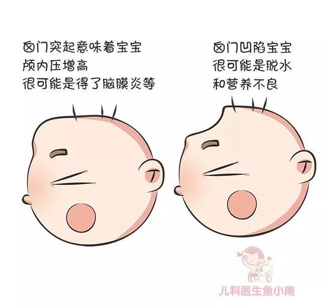 后囟门凹陷是什么原因图片