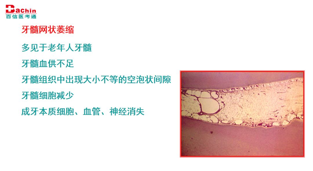 成牙本质细胞突图片