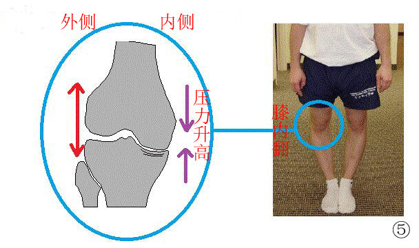 膝关节内外旋示意图图片