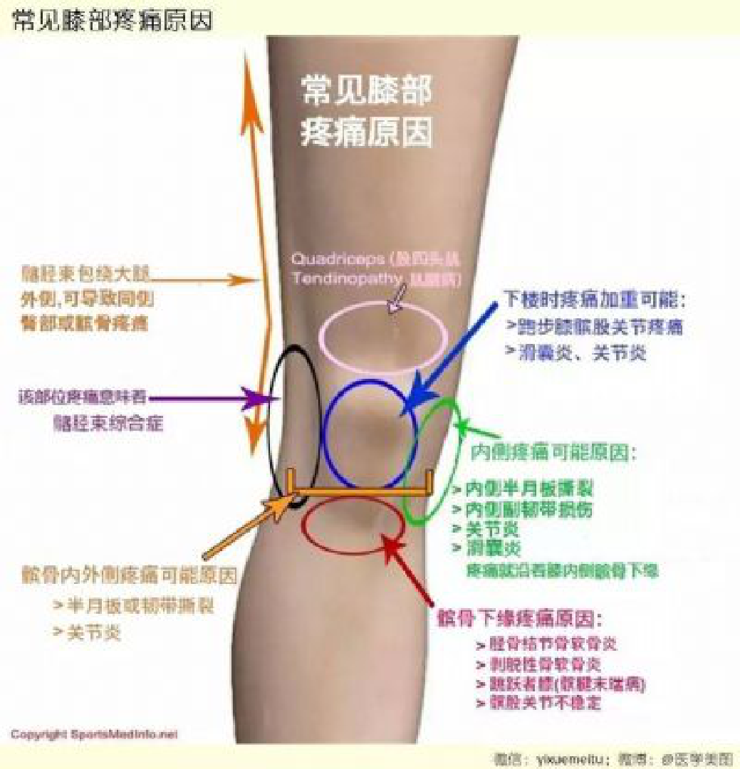 常见膝关节疼痛的体格检查原创