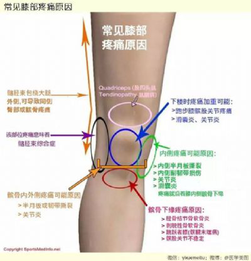 膝反张多位股四头肌无力