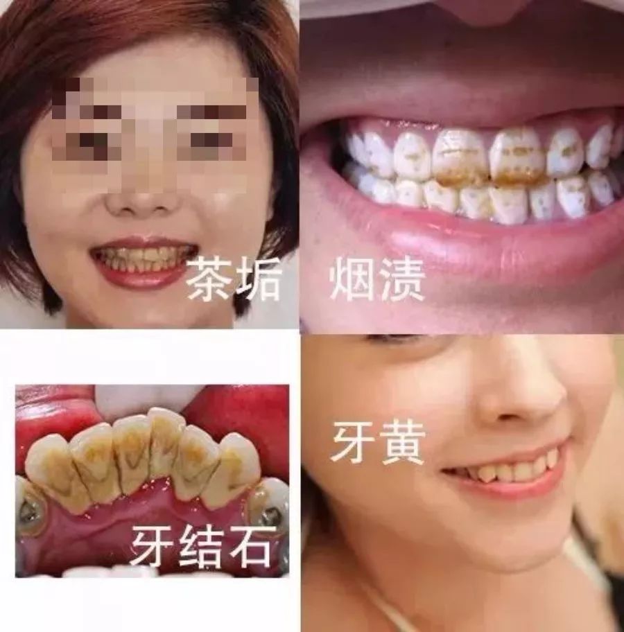 牙黄分几种图片
