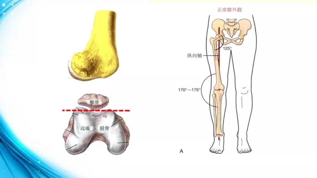 从侧面观,股骨外侧髁比内侧髁更多地向前突出,股骨干在伸向膝关节的