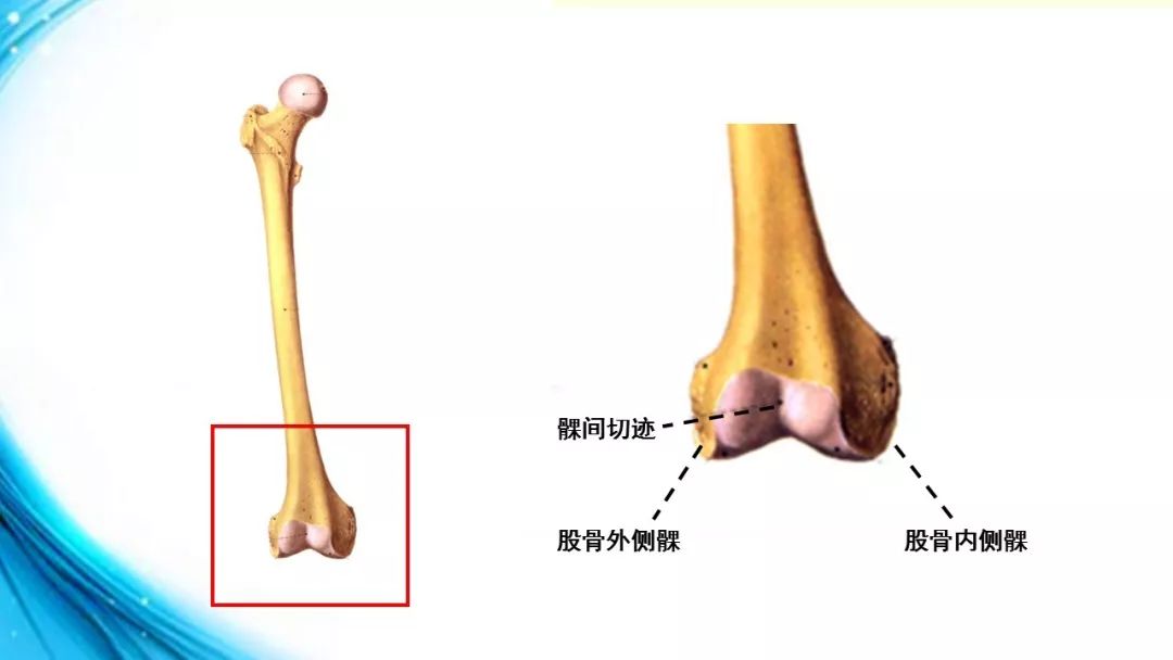 股骨内侧髁骨示意图图片
