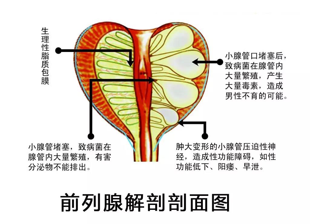 前列腺液怎么提取图片