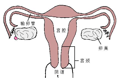 输卵管的管腔狭小,管壁薄且缺乏粘膜下组织,伸缩性远远不如子宫