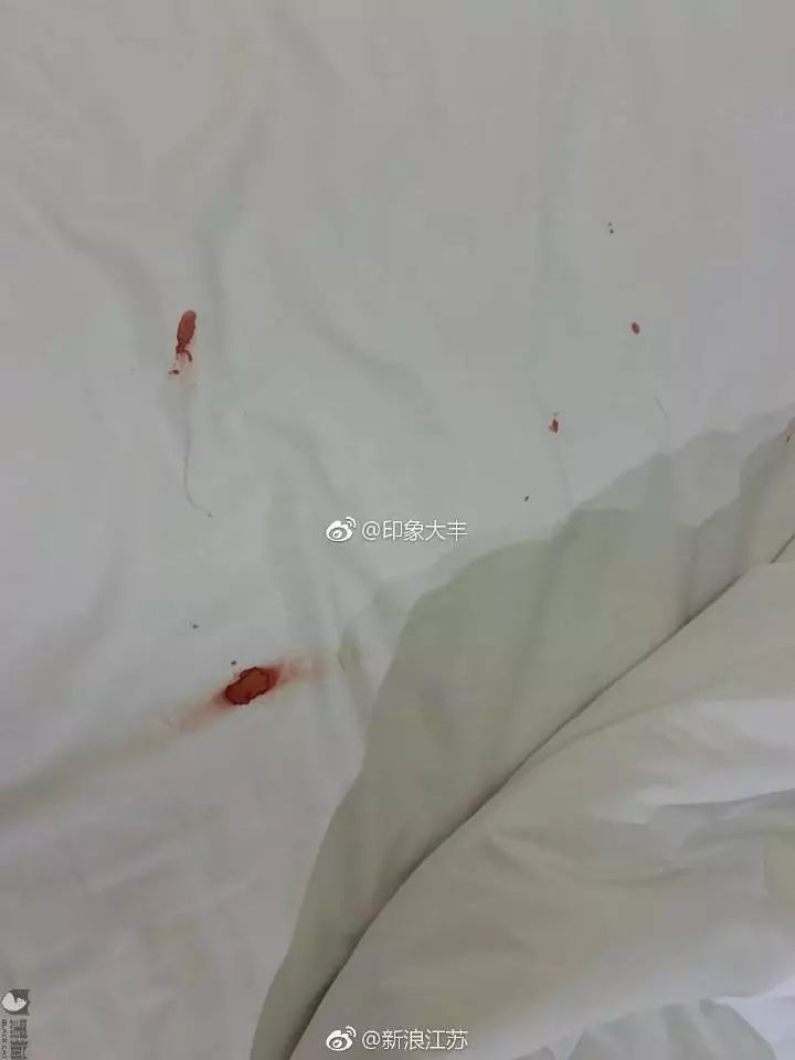 床单上的落红图片