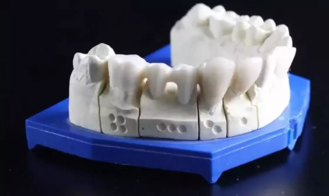 com) 牙齿的模型直接建模是非常困难的,这个时候我们会用到三维扫描仪