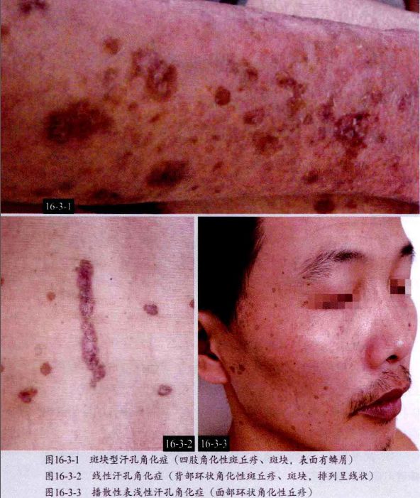 红色斑疹的图片图片