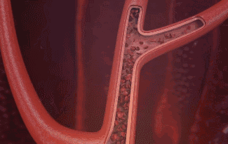静脉血动脉血流动图图片