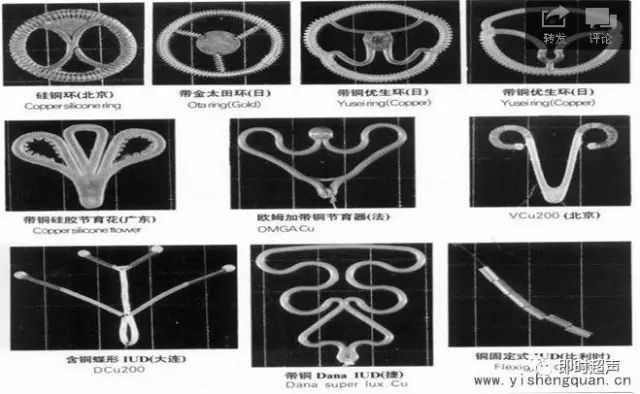 對宮內節育器(iud),你瞭解多少?_子宮