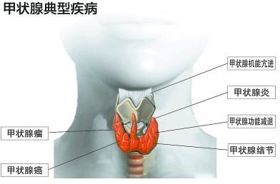 甲状腺属于哪个科 来自搜狐网