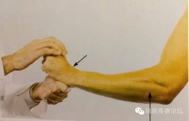 2,桡侧腕长伸肌(桡神经;c5,c6)患者对抗阻力在肘关节处伸直前臂.