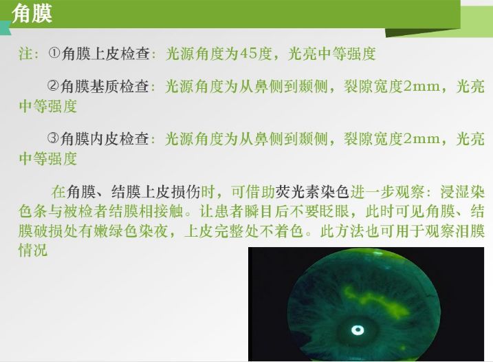 【收藏】裂隙灯的结构与使用