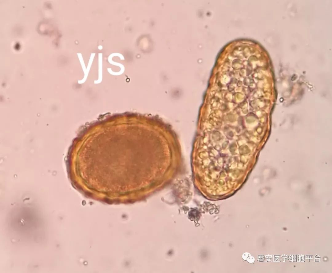 图6左:受精蛔虫卵,右:未受精蛔虫卵(杨金生供)3