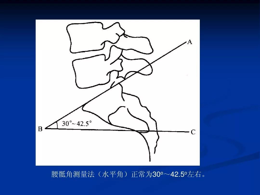 整脊影像学诊断