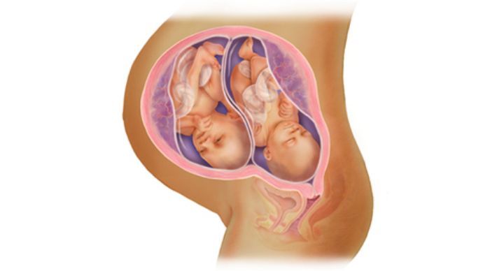 自序我的双胎子宫日记