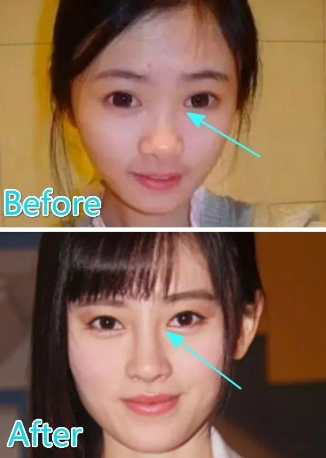 为掩盖整容后遗症不惜让剧组10级磨皮到只剩五官就算再换头也难解决