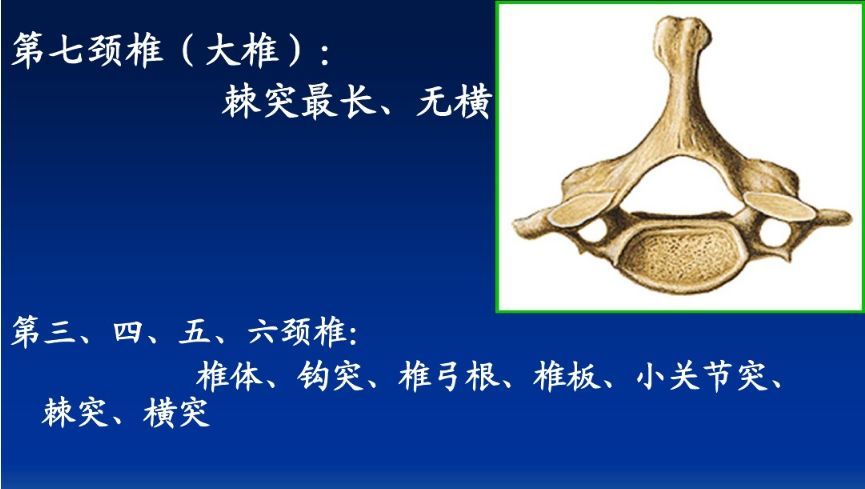 颈椎精细解剖颈椎病