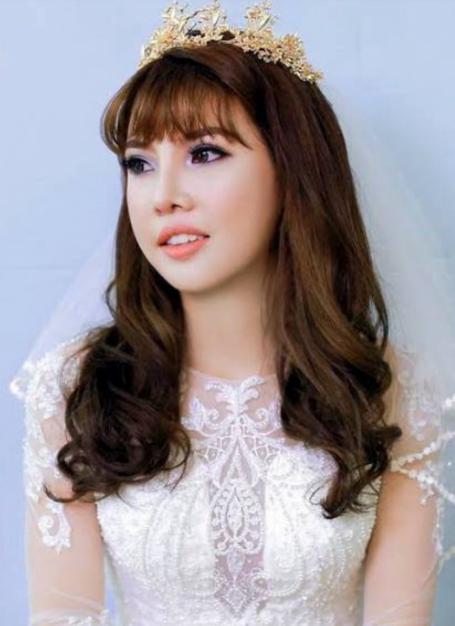 当初花9万整容嫁富豪,谁还记得她,如今活成此状_郭金凤