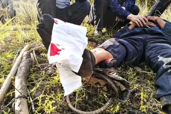 男子去拜山踩上野猪夹,痛到妈都无认得!_夹子