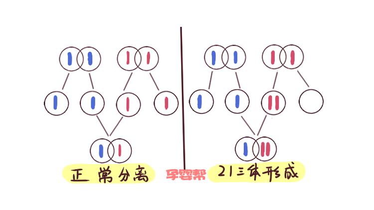 断掌也不是因为孩子将来会大富大贵,而是孩子患有21三体综合征,也叫