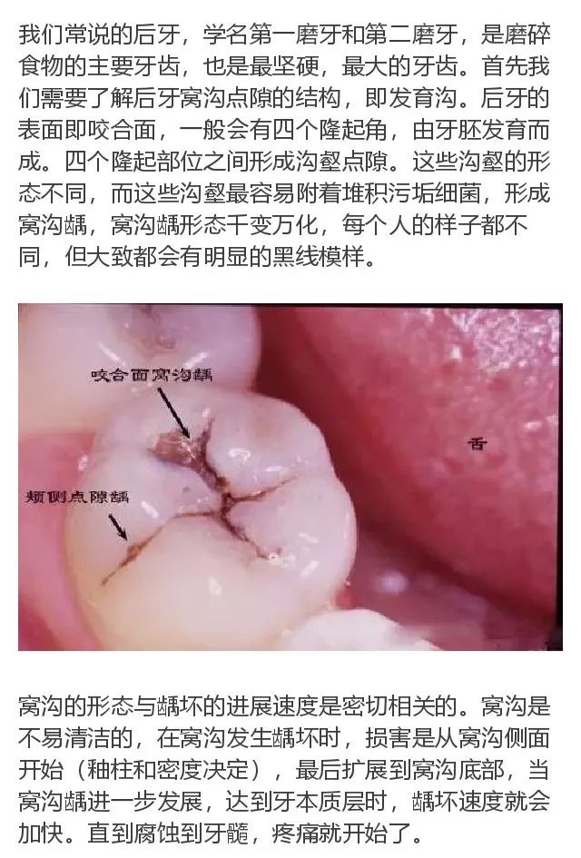 牙齿生长线图片