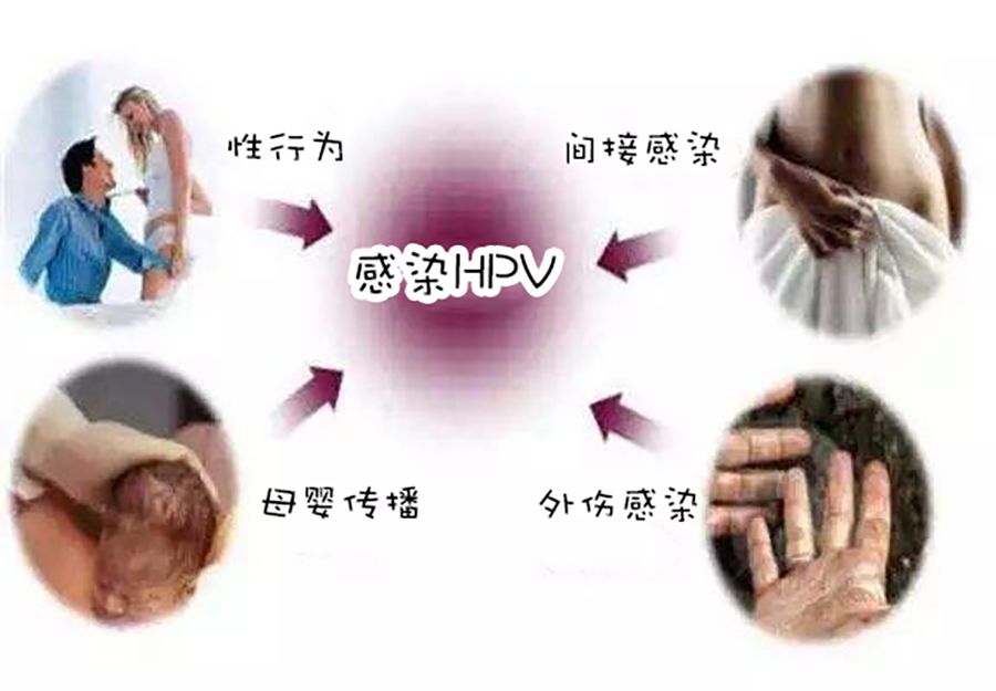 hpv病毒初期症状有哪些图片