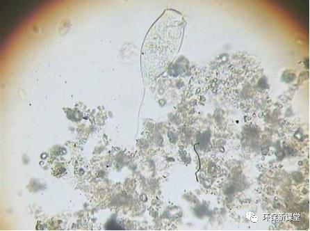 钟虫显微镜图片