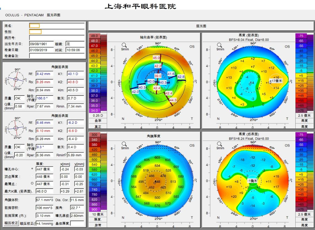 图itrace检查患者接受了itrace,角膜地形图,pentacam眼前节分析系统