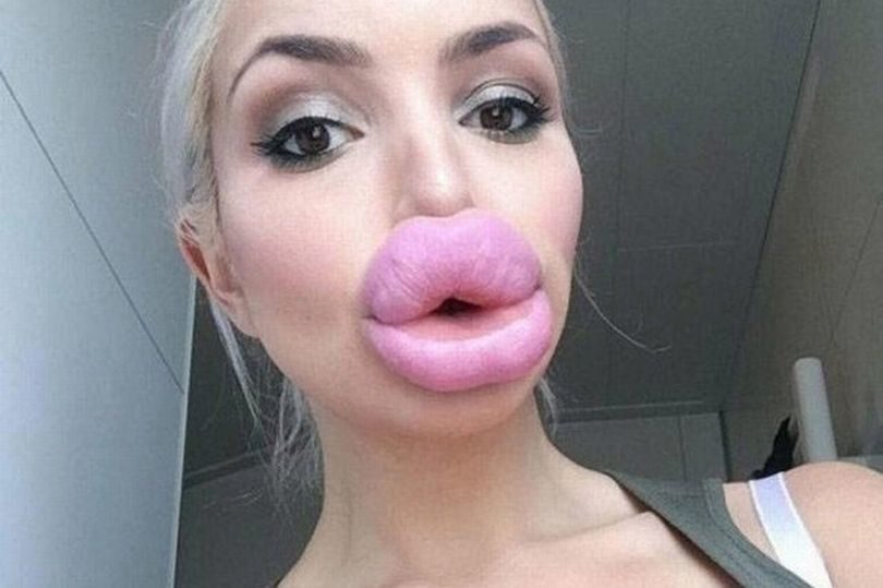 世界上最厚的嘴唇图片