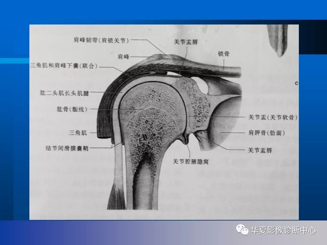 肩关节横断面解剖图片