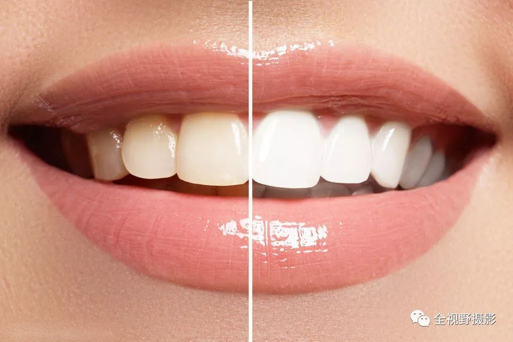 牙齿的十种美学形态与功能