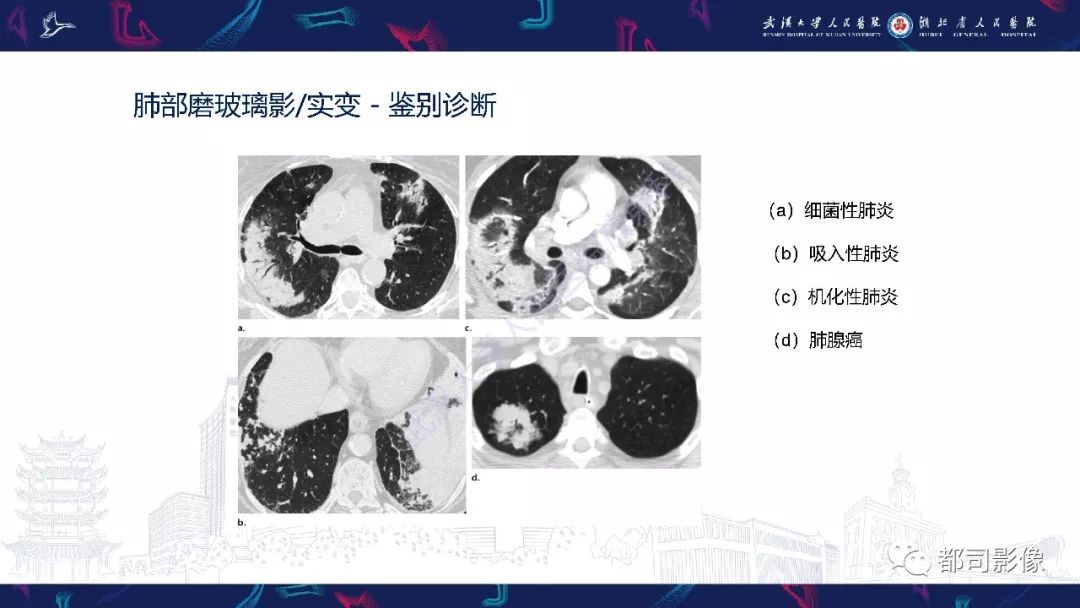 韦格纳肉芽肿典型与非典型胸部ct表现