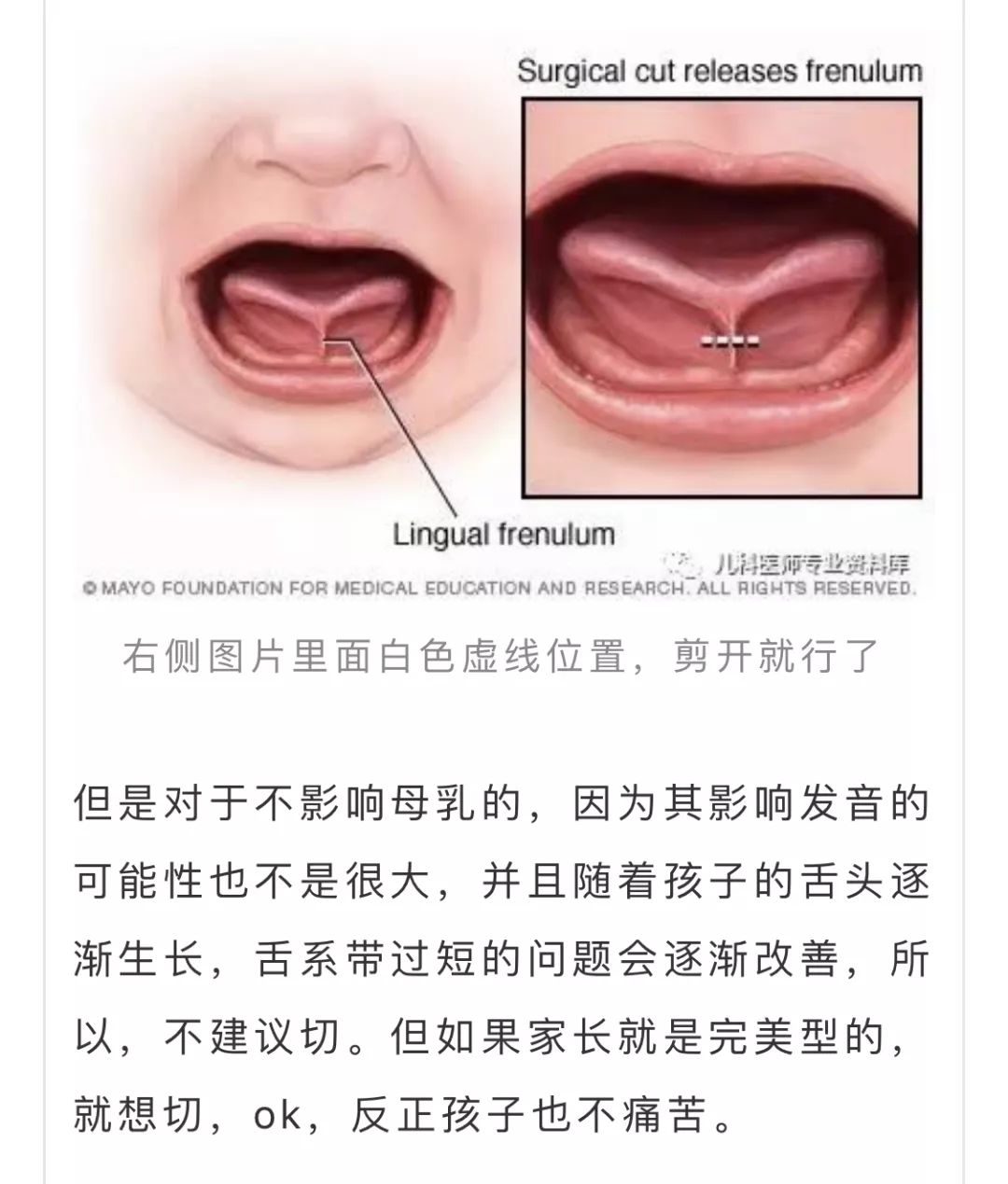 宝宝舌头像少块皮图片图片