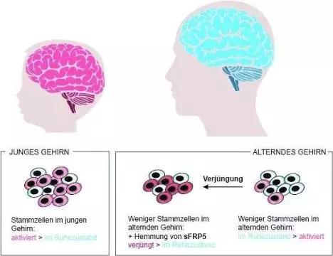 激活休眠中的神經幹細胞或可啟動衰老大腦的神經修復