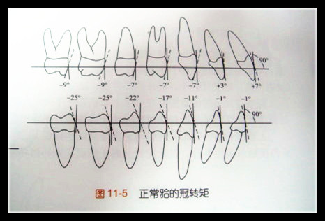 标准牙倾斜度示意图图片