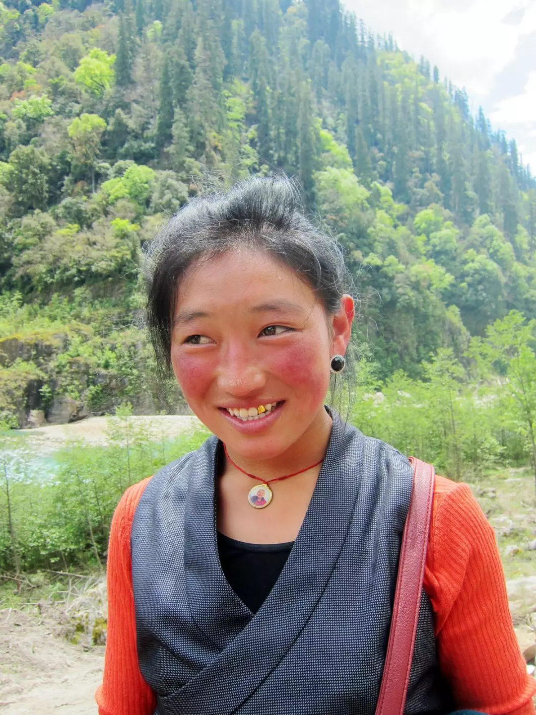 西藏游没几天就晒成红脸蛋,为什么还不容易恢复?