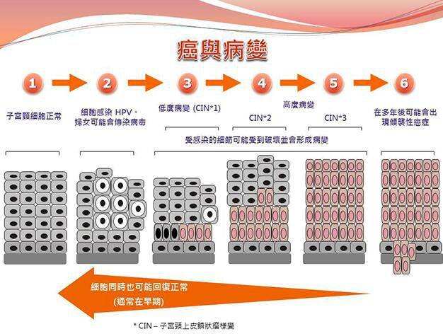 宫颈cin3的图片图片