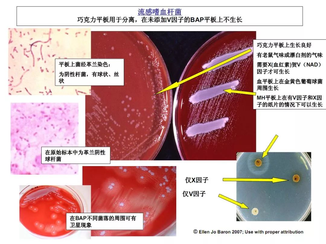 细菌鉴定流程图,值得收藏!