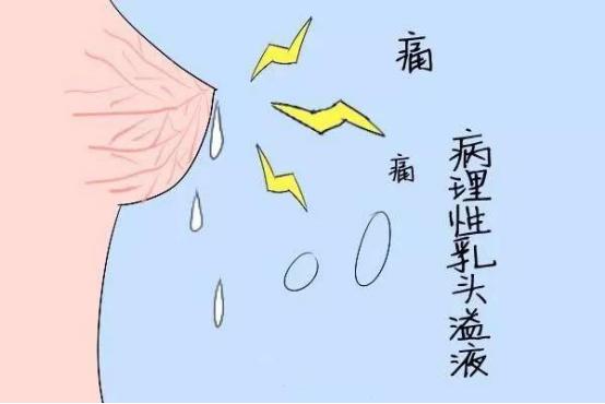 乳头炎症状图片