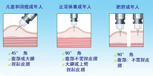 胰岛素的注射角度图片