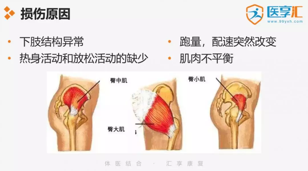 痛点,然后缓慢的活动膝关节,如果疼痛缓解,则证明我们是髂胫束的问题