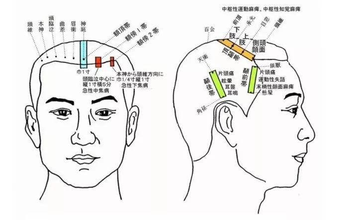 董氏针灸学全息图谱图片