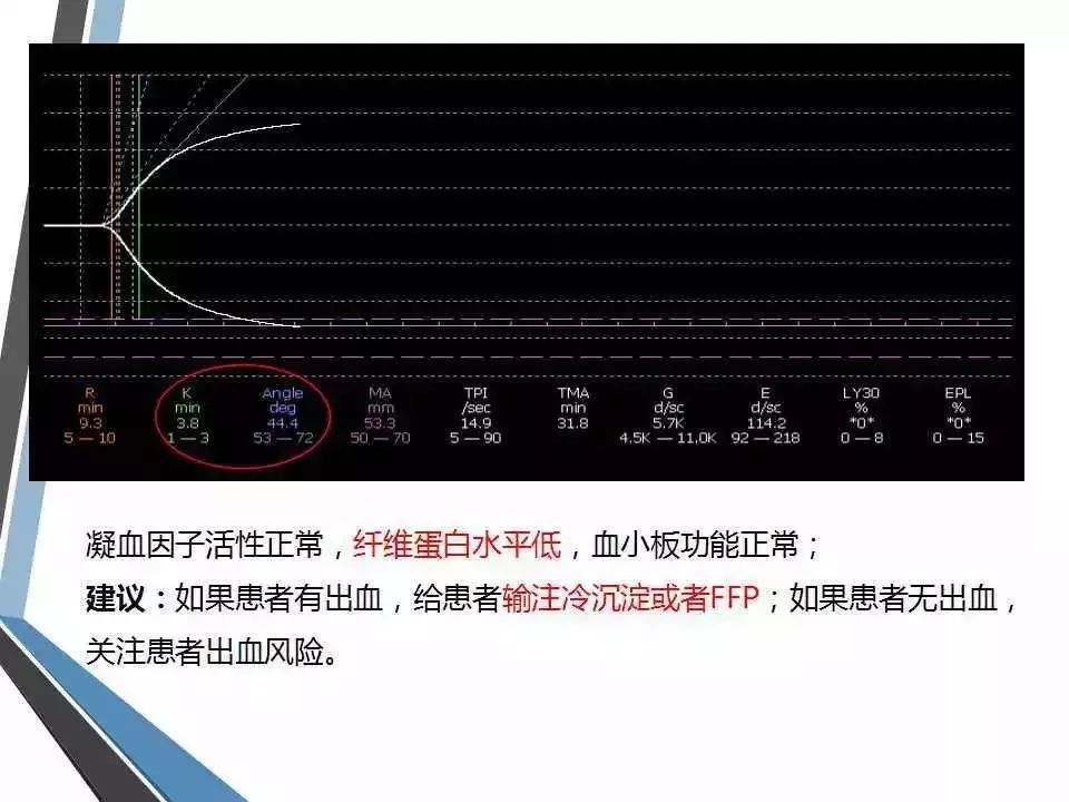 血栓弹力图异常图片