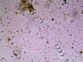 小胶质细胞阿米巴原虫图片