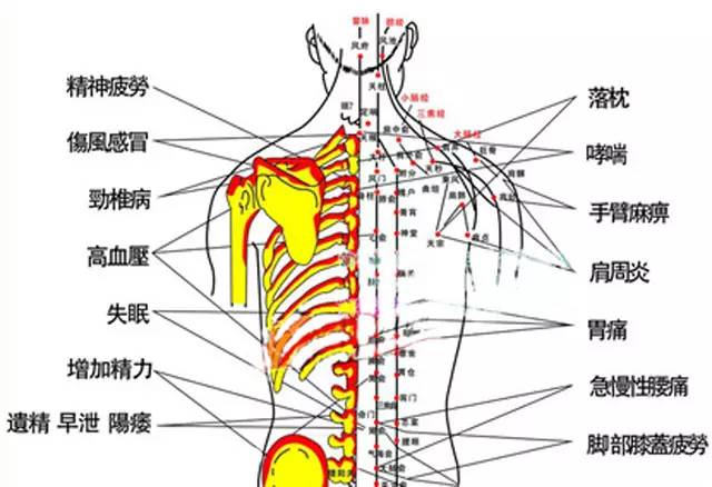 拔罐后的罐印都暗示了啥?看看吧!