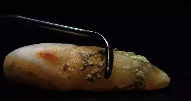 学会2方法,口臭没有了!