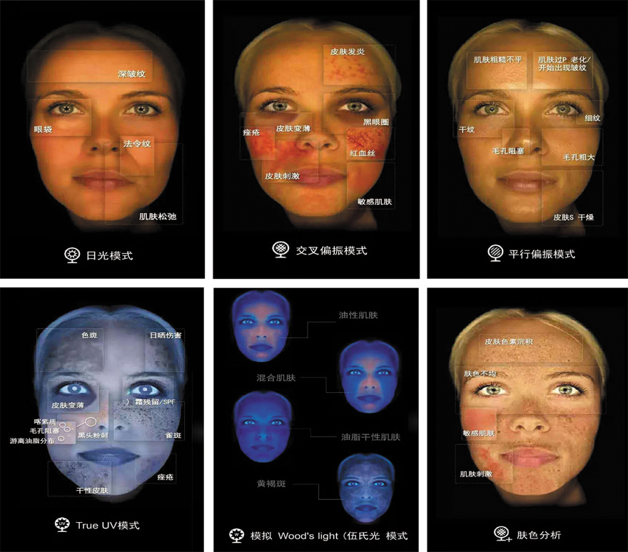 皮肤检测仪分析图解图片